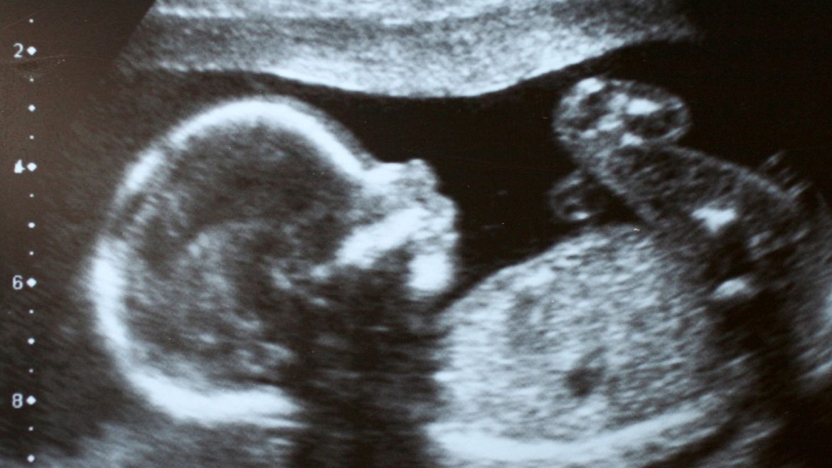 <a href='https://news.sky.com/story/maternity-13546586'>Inside UK's maternity crisis: What it's really like to give birth</a>
